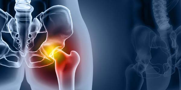Hip Clinic in Nagpur