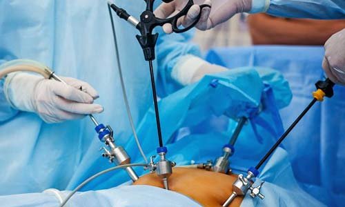General & Laparoscopic Surgery